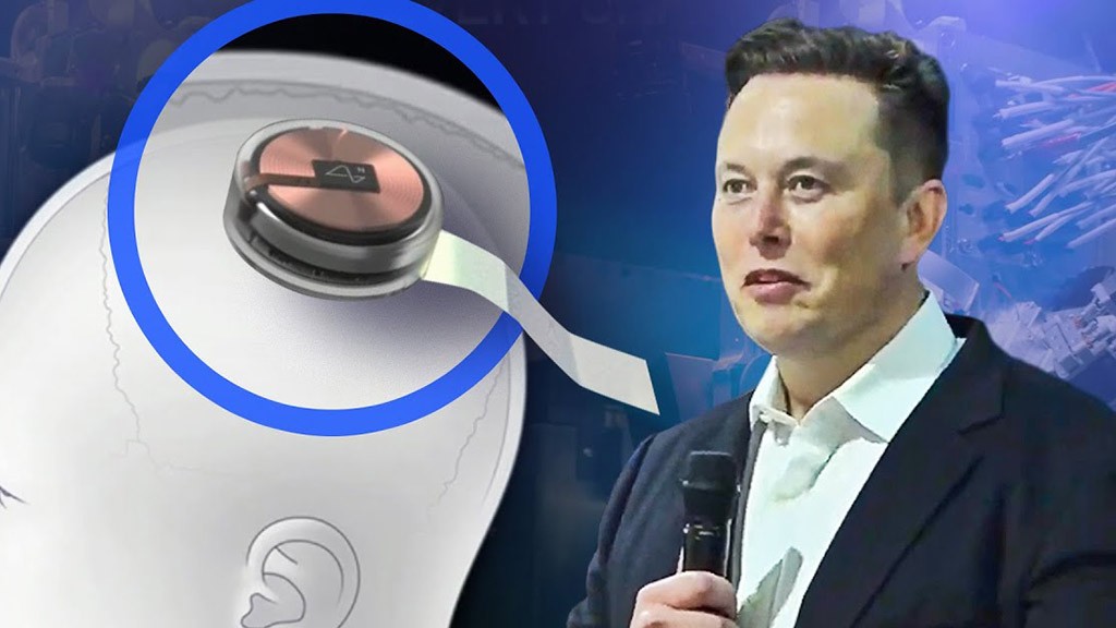 Ο Elon Musk είπε ότι η Neuralink θα αρχίσει να εμφυτεύει τσιπ σε εγκεφάλους ανθρώπων το 2022